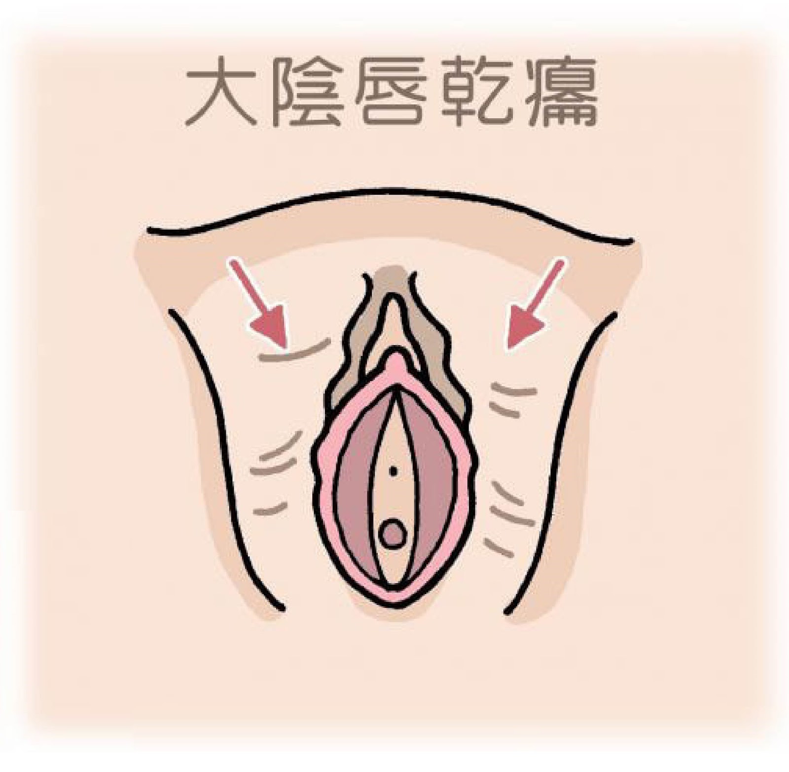 圖片1