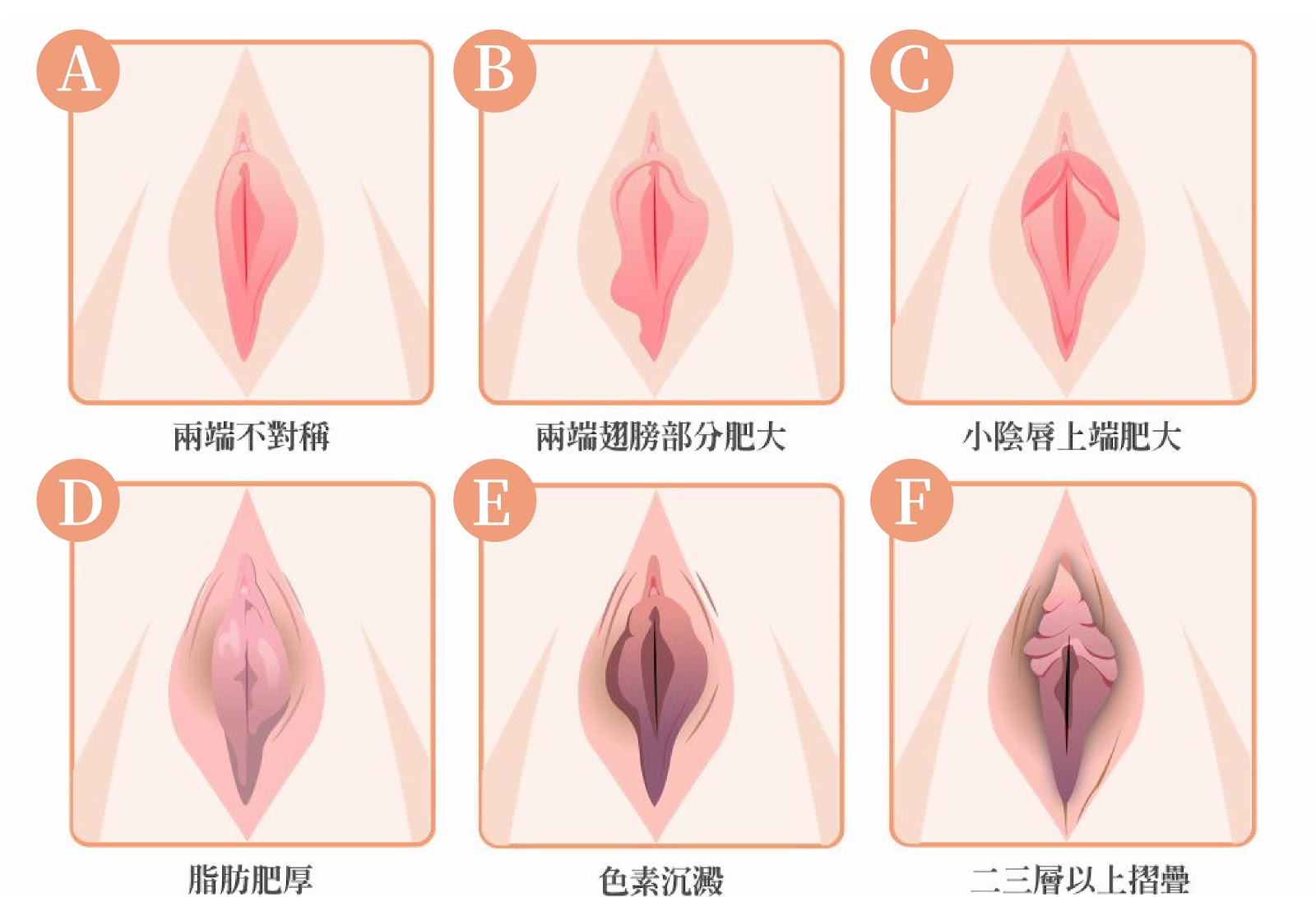 圖片2