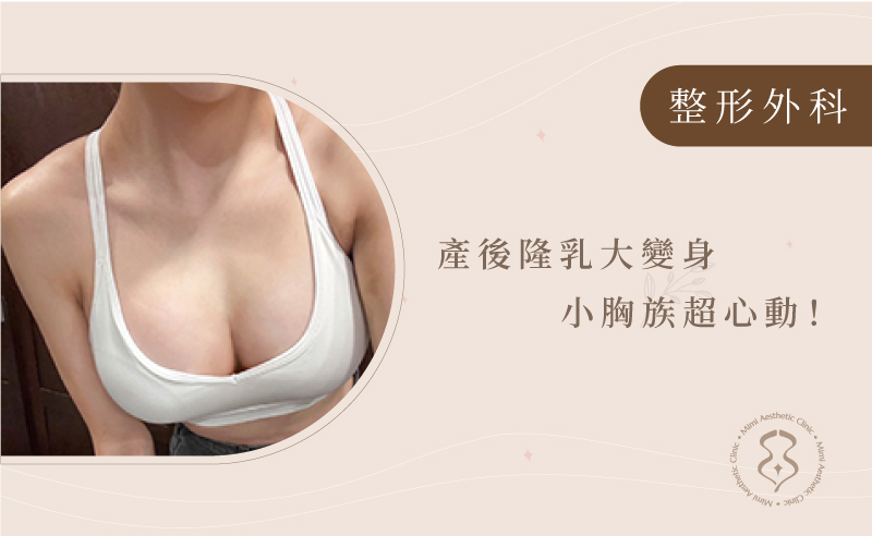 療程BANNER5