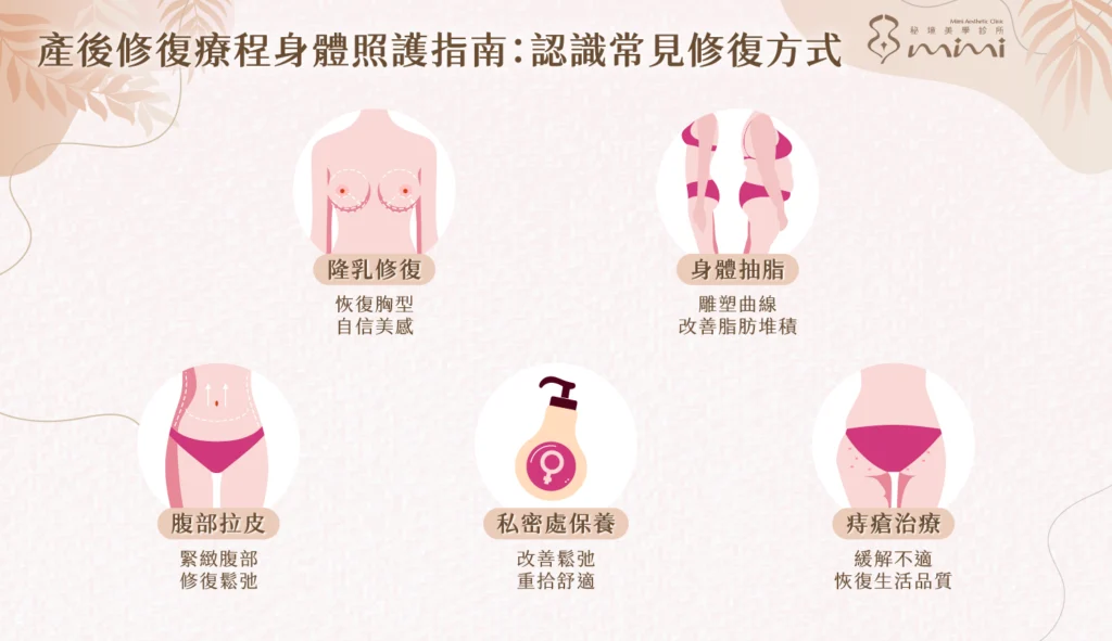 產後修復