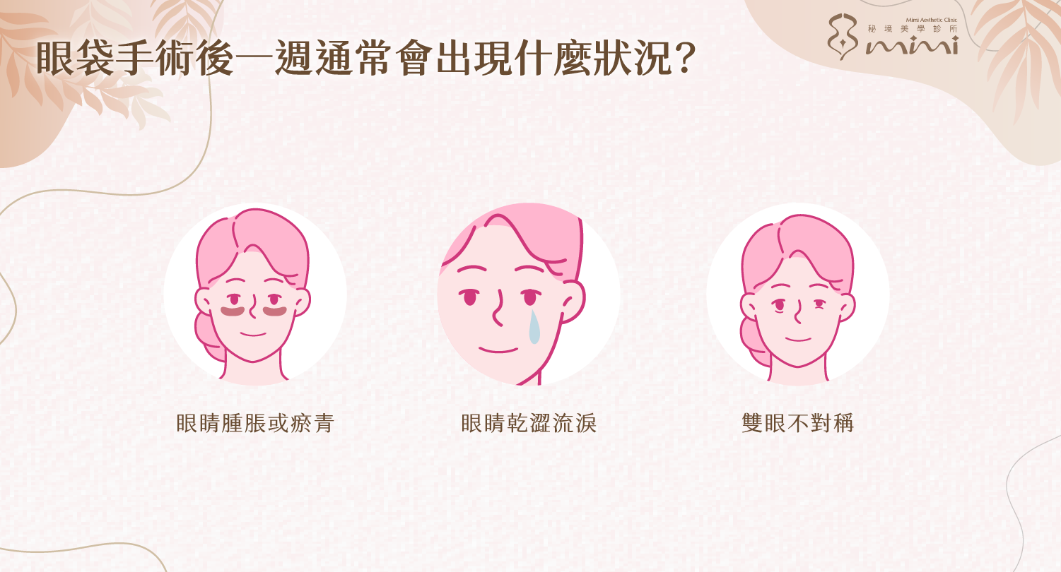 台北眼袋手術推薦